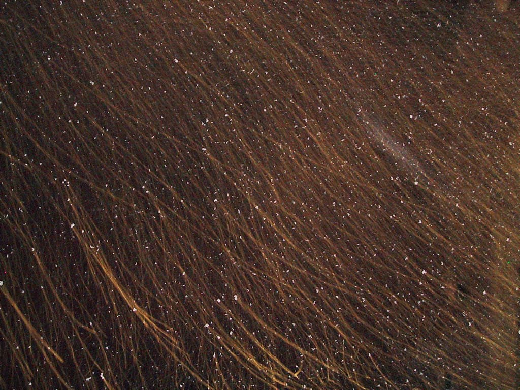 Dandruff
