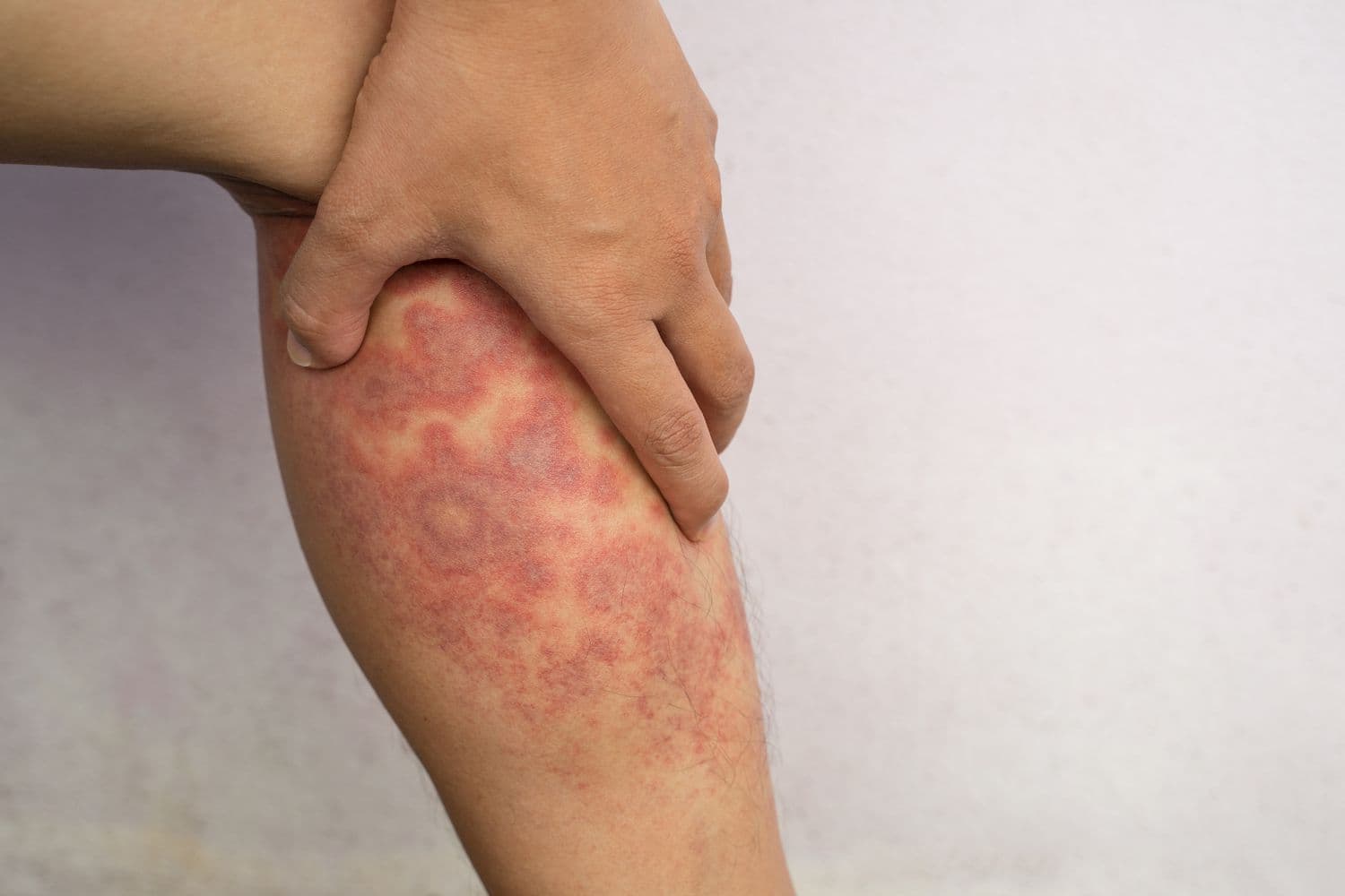 Skin Problems